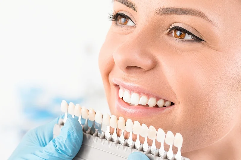 Sbiancamento Denti - Studio Dr. Alessandro Solinas Sbiancamento Denti - Studio Dr. Alessandro Solinas